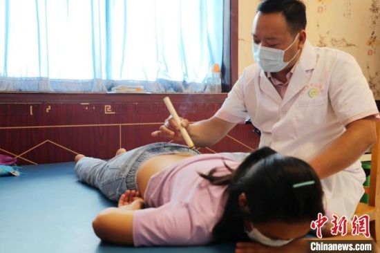 平乡县节固乡中心卫生院医务人员在为患者进行艾灸。　李冰冰 摄